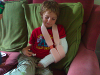 Ebi with his new plaster cast